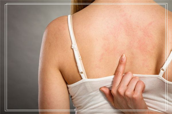 梦见遍地是屎身上沾屎